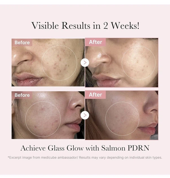 Набор для лица Medicube PDRN Pink Glow Kit с PDRN и коллагеном Medicube Pink Glow Kit фото